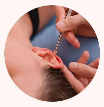 Auriculoterapia em Joinville