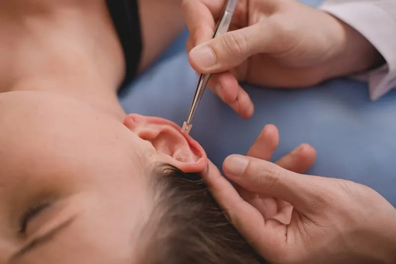 Tratamento de Auriculoterpia em Joinville